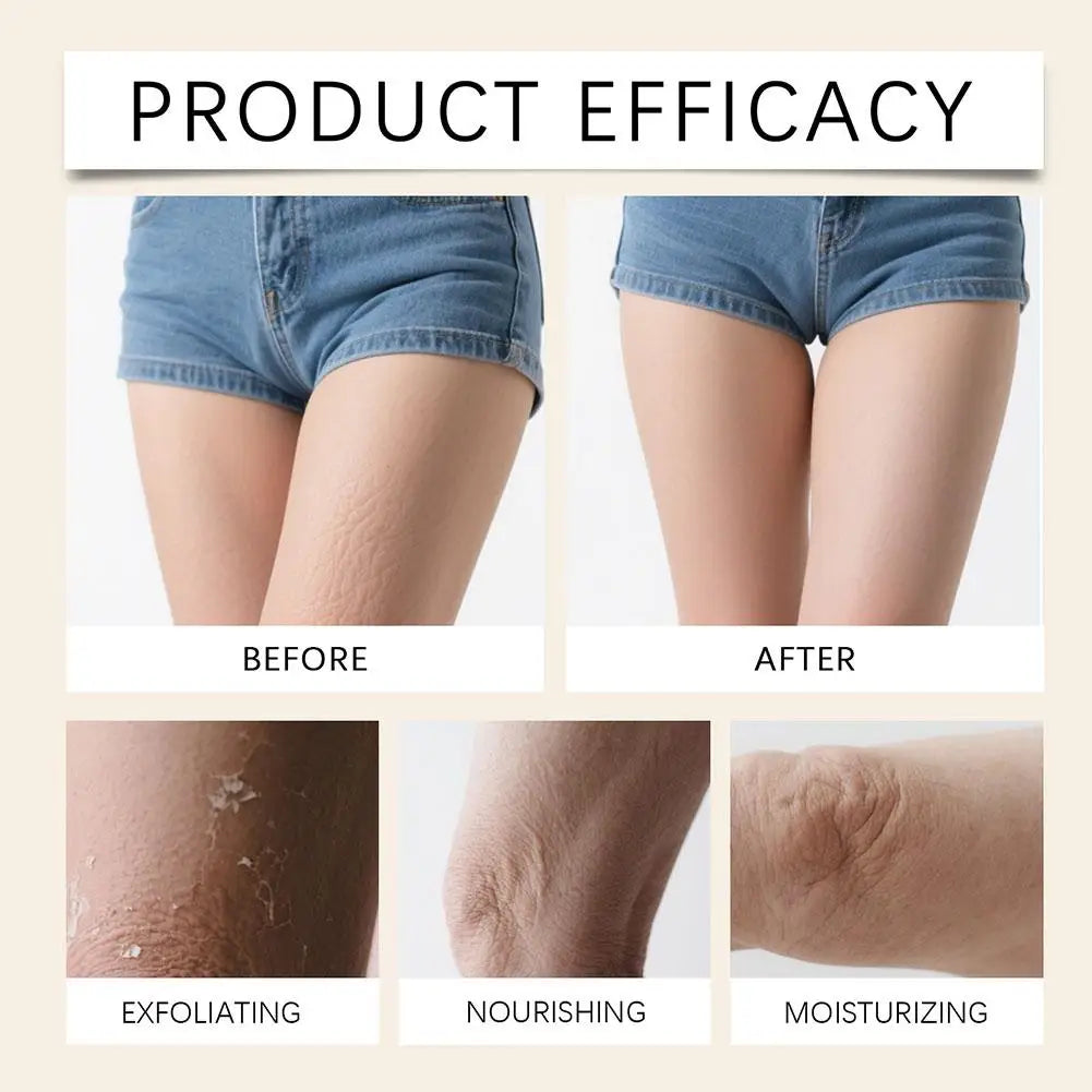 Turmeric Body Scrub – All-Natural Exfoliator